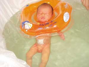 先天性後鼻孔閉鎖