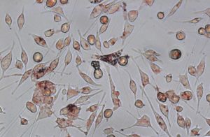 噬脂細胞 噬脂細胞