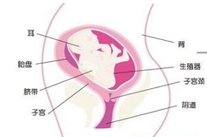 胎兒橫位 胎兒橫位