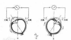 眼電圖 眼電圖