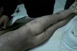 虐待致死 虐待致死