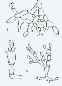 棉立枯病病菌1.菌絲體2.擔子及擔孢子
