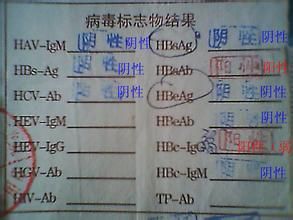 B肝六項 B肝六項