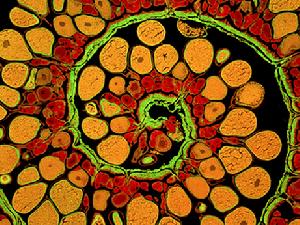 卵巢螺鏇這是一個發育中的卵子，在琵琶魚的卵巢中做螺鏇式移動。攝影師在卵巢壁上加了顏色，看起來特別明顯。這幅圖既有其藝術美感，又具有科學價值，可以證明卵巢和卵子的結構。 