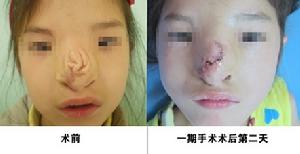 圖片由105醫院整形美容中心提供