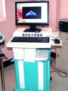 感染性陰道炎 感染性陰道炎