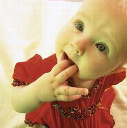 新生兒膽紅素腦病