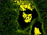 顯微鏡CCD拍攝的螢光圖片