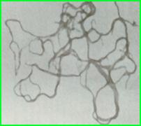 結核分枝桿菌