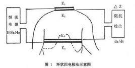 心阻抗圖 心阻抗圖