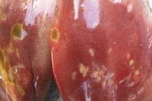 肝臟出現黃綠色火山口樣壞死