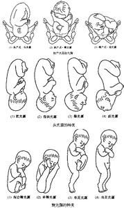 胎方位 胎方位