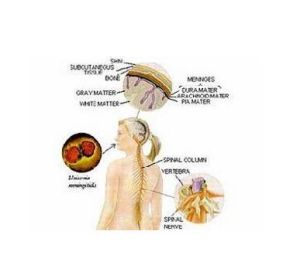 流行性乙型腦炎病毒引發乙腦