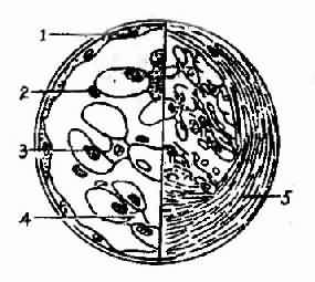 老年人急性感染後腎炎