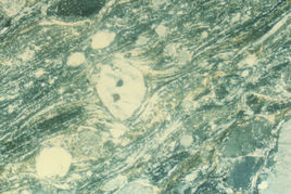 眼球狀構造 眼球狀構造