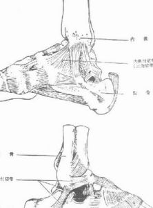 韌帶破裂 韌帶破裂