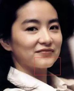 美人溝下巴 美人溝下巴