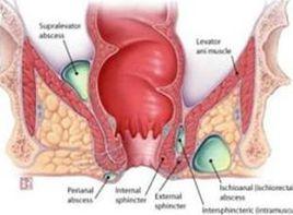 肛門會陰區潮濕不潔 肛門會陰區潮濕不潔