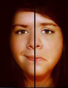 雙相情感障礙 雙相情感障礙