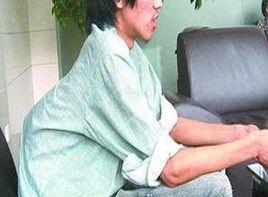 脊柱後突 脊柱後突