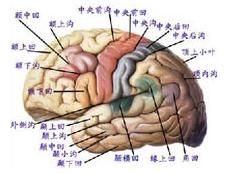 自發性腦室內出血 自發性腦室內出血