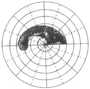原發性開角型青光眼