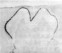 大鼠牙胚組織發育過程中