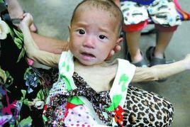 飢餓娃娃 飢餓娃娃