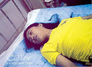 非特異性慢性甲狀腺炎