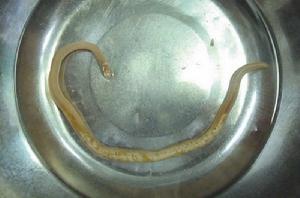 胸部寄生蟲 胸部寄生蟲