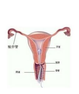 急性尿道綜合症