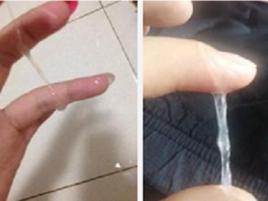 白帶拉絲 白帶拉絲