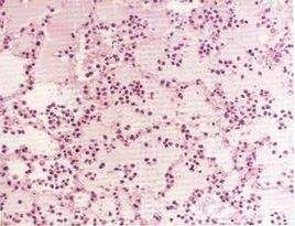 地貝卡星 地貝卡星