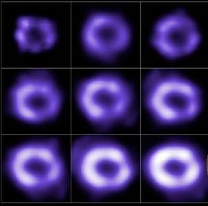 超新星1987A的氣體環