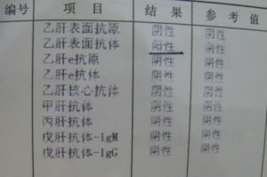 B型肝炎表面抗體
