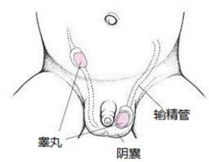 成人腹股溝斜疝 成人腹股溝斜疝