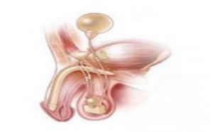 韓式尿道下裂修復術 韓式尿道下裂修復術