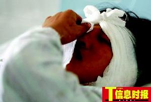 軀體疾病伴發的精神障礙