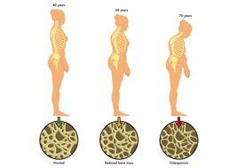 絕經前期 絕經前期