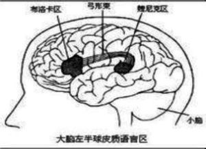 布洛卡區 布洛卡區