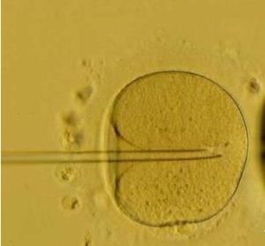 體外人工受精 體外人工受精