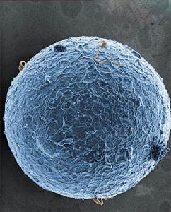 人造卵子 人造卵子