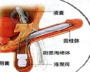 心理性陽痿 心理性陽痿