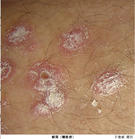 （圖）吉林市皮膚病醫院