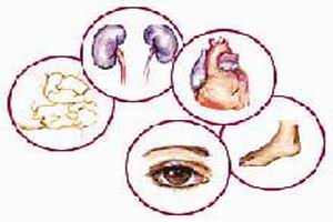 糖尿病酮症酸中毒