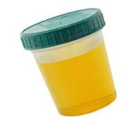 24小時尿蛋白定量