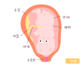 人工破膜 人工破膜