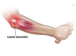 康肘舒絡平痛貼 康肘舒絡平痛貼