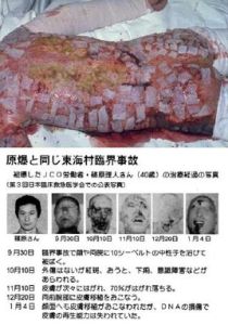 日本東海村核臨界事故