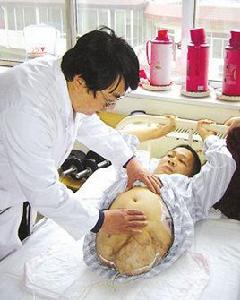 高位截肢 高位截肢